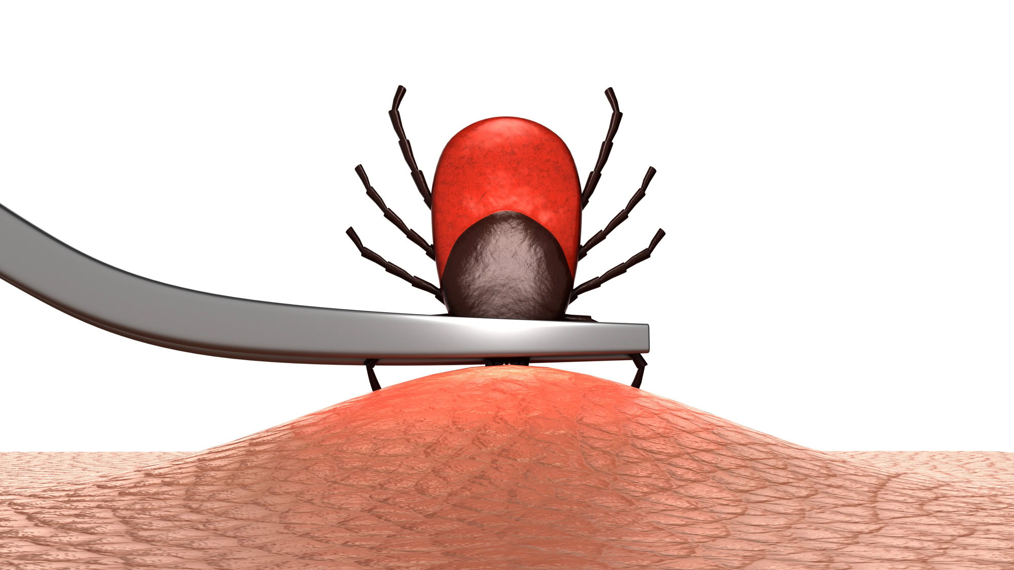 Close-up illustration of metal tweezers removing a tick from pets skin.